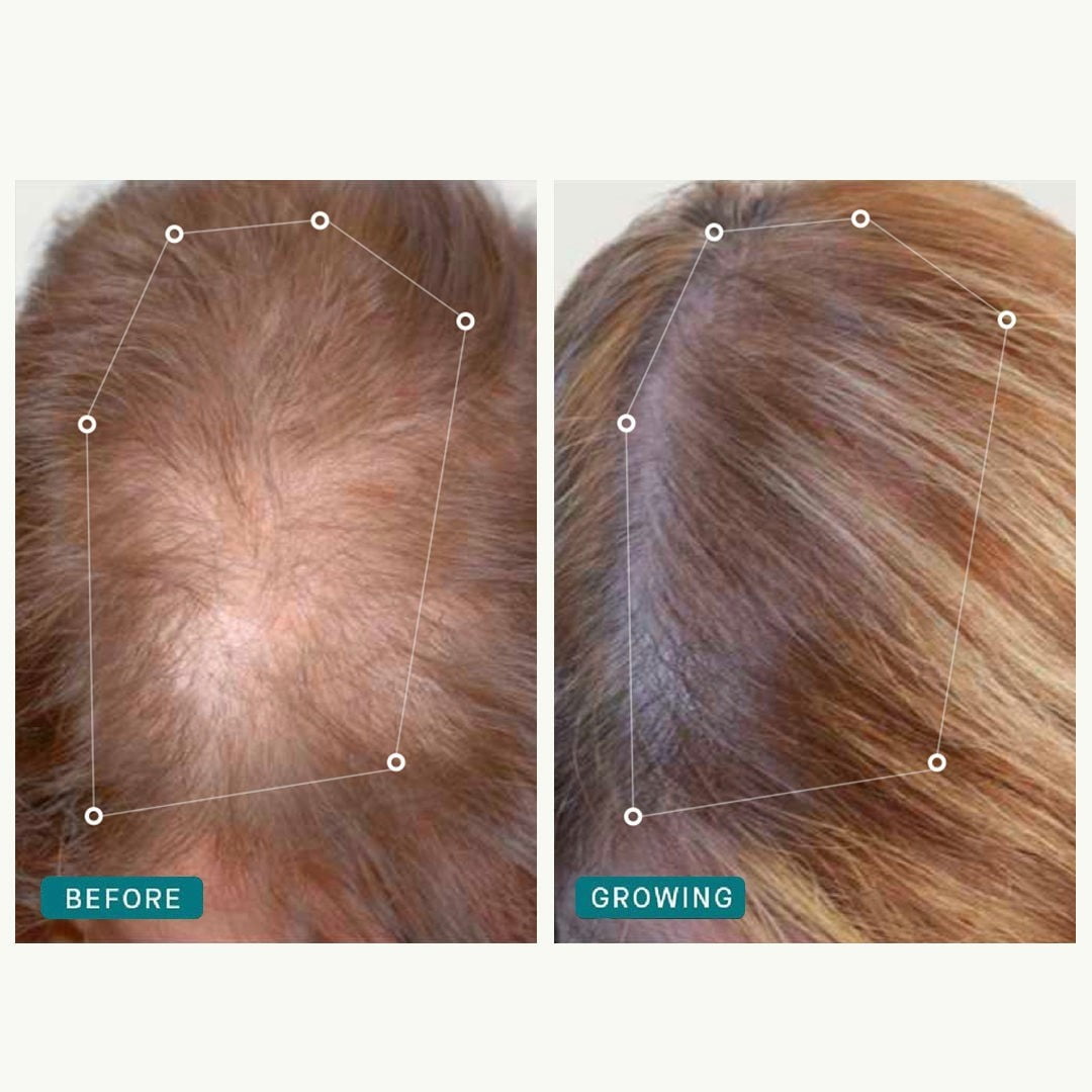 How long does nutrafol take to work
